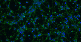 Fluoreszenzmikroskopische Aufnahme von menschlichen Neuronen; grün: das neuronale Netzwerk, blau: die Zellkerne. | Foto: Tanja Schwerdtle.