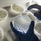 This photo shows several samples and hands wearing gloves in a biology laboratory.